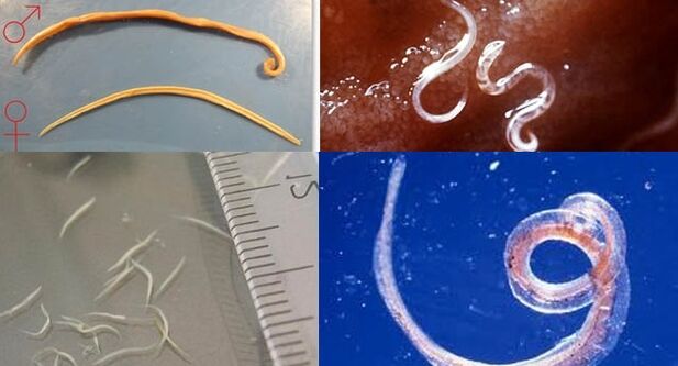 Parasites