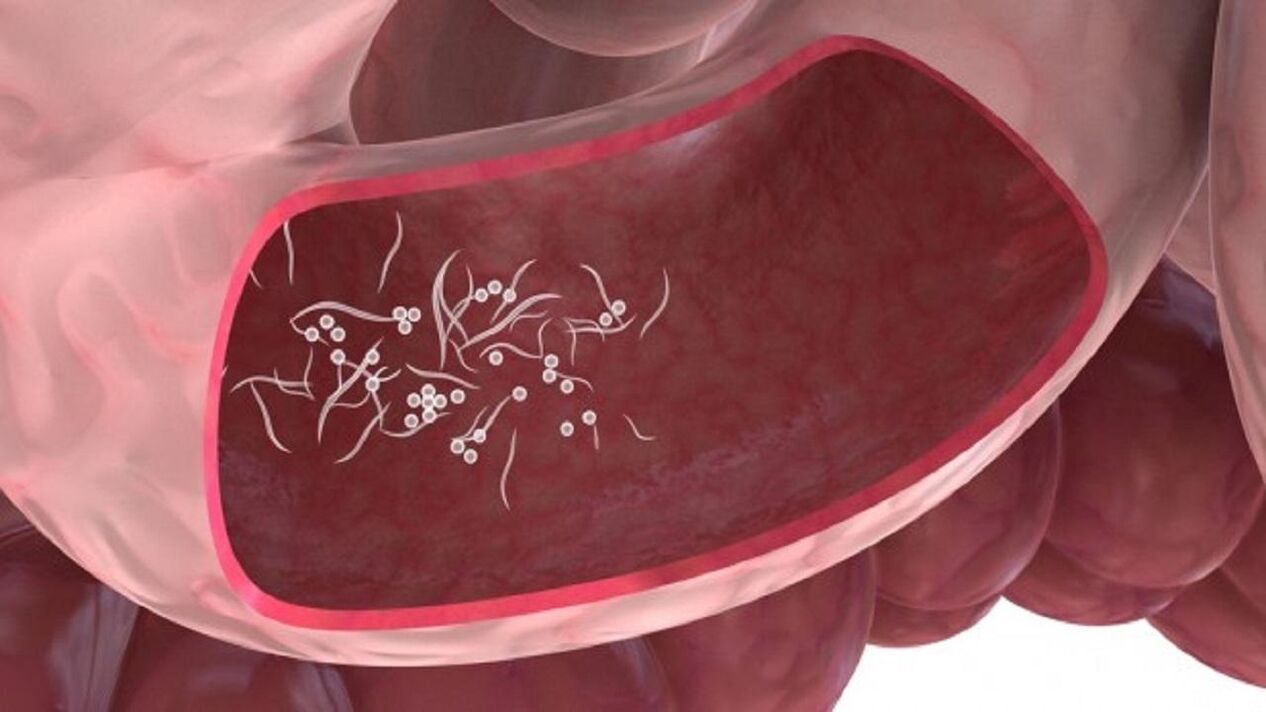 Parasites Giardia dans le foie